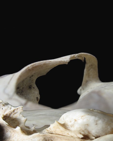 Bone Landscape 2, 2007